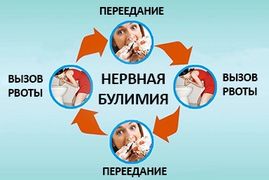 Лечение булимии в Североморске
